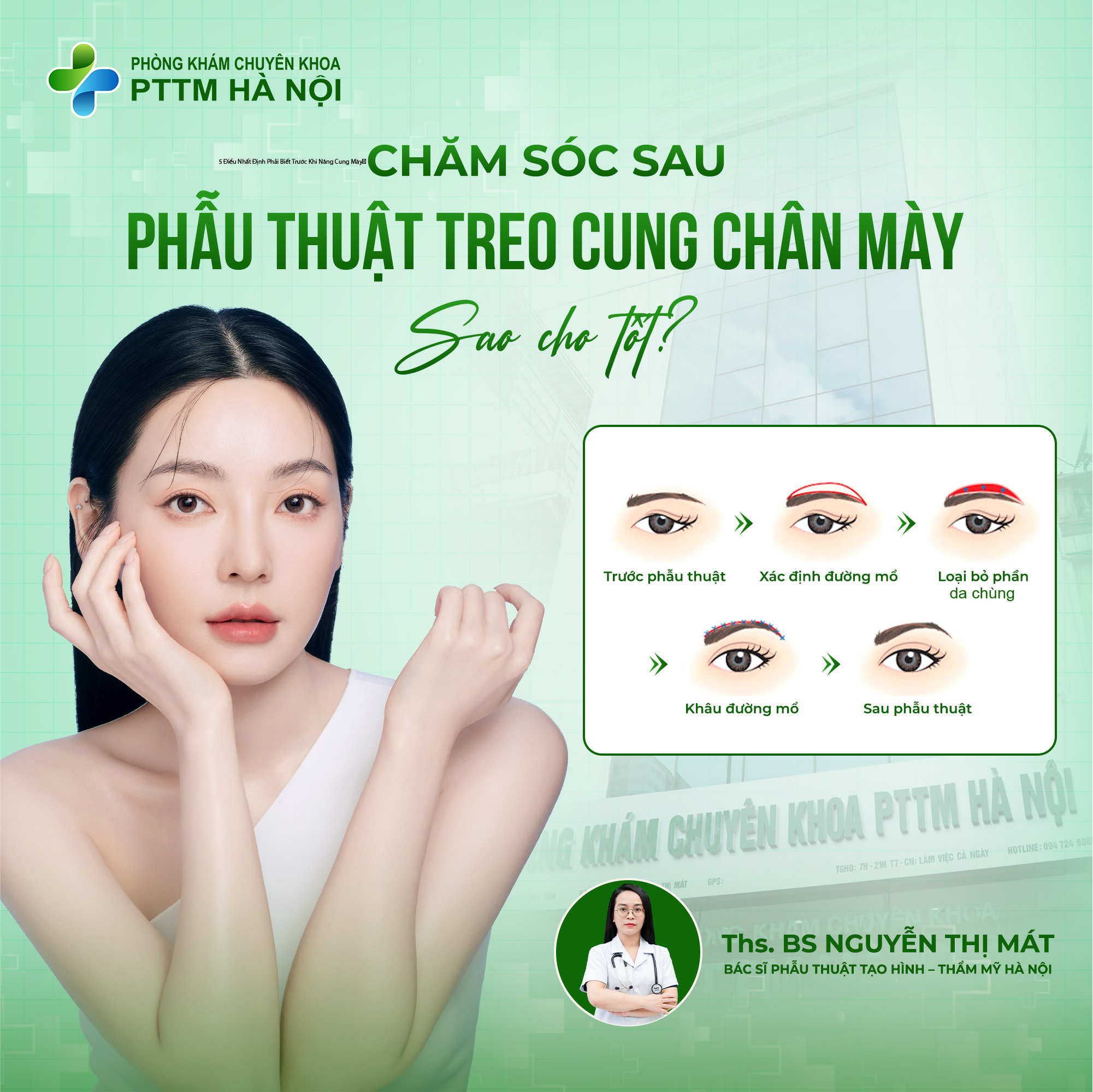 Những Điều Cần Lưu Ý Trước Và Sau Khi Nâng Cung Mày