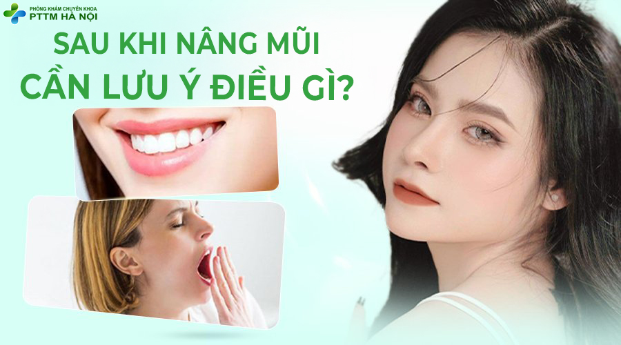 Những Điều Cần Lưu Ý Khi Nâng Mũi
